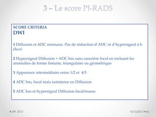 SCORE CRITERIA

DWI
1 Diffusion et ADC normaux. Pas de réduction d’ADC ni d’hypersignal à b
élevé
2 Hypersignal Diffusion + ADC bas sans caractère focal en incluant les
anomalies de forme linéaire, triangulaire ou géométrique
3 Apparence intermédiaire entre 1/2 et 4/5
4 ADC bas, focal mais isointense en Diffusion
5 ADC bas et hypersignal Diffusion focal/masse

JFR 2013

10/15/2013

26

 