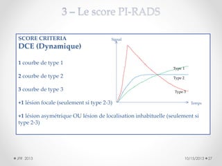 SCORE CRITERIA

Signal

DCE (Dynamique)
1 courbe de type 1
Type 1

2 courbe de type 2
3 courbe de type 3
+1 lésion focale (seulement si type 2-3)

Type 2

Type 3
Temps

+1 lésion asymétrique OU lésion de localisation inhabituelle (seulement si
type 2-3)

JFR 2013

10/15/2013

27

 