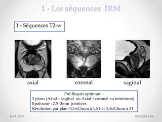 1 - Séquences T2-w

axial

coronal

sagittal

Pré-Requis optimum :
3 plans (Axial + sagittal ou Axial + coronal au minimum)
Epaisseur : 2,5 -3mm jointives
Résolution par plan: 0,5x0,5mm à 1,5T et 0,3x0,3mm à 3T
JFR 2013

10/15/2013

4

 