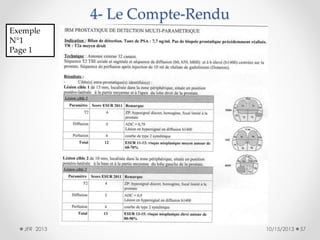 4- Le Compte-Rendu
Exemple
N°1
Page 1

JFR 2013

10/15/2013

57

 