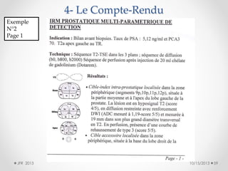 4- Le Compte-Rendu
Exemple
N°2
Page 1

JFR 2013

10/15/2013

59

 