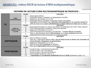 MEMENTO : critères ESUR de lecture d’IRM multiparamétrique

JFR 2013

10/15/2013

61

 
