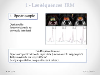 4 - Spectroscopie
Optionnelle :
Peut être ajoutée au
protocole standard

Pré-Requis optimum :
Spectroscopie 3D de toute la prostate ( mono-voxel : inapproprié)
Taille maximale du voxel : 0,5cm3
Analyse qualitative ou quantitative ( ratios )

JFR 2013

10/15/2013

7

 