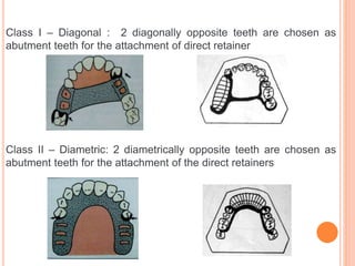 Dental Rp Classification classification RPD.pptx