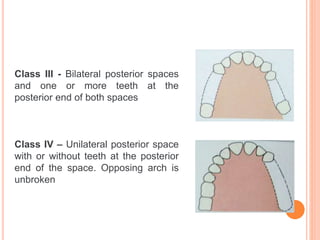 classification RPD.pptx