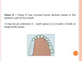 Dental Rp Classification classification RPD.pptx