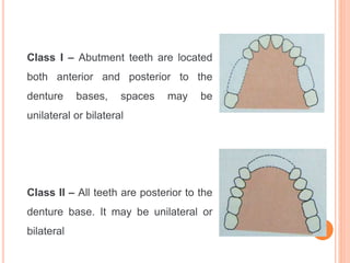 Class 2 Mod 2 Rpd classification RPD.pptx
