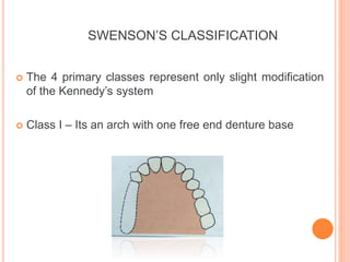 Kennedy Classes Rpd classification RPD.pptx