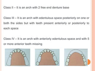 Craddock Classification Rpd classification RPD.pptx