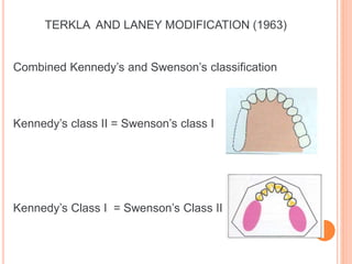 Kennedy Classification Rpd Examples classification RPD.pptx