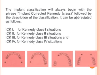 Kennedy Classes Rpd classification RPD.pptx