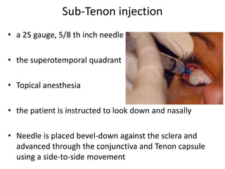 Tenon Injection Classifications of etio pathogenesis of uveitis, anterior uveitis- dr.k ...