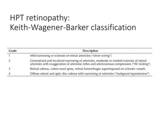 HPT retinopathy:
Keith-Wagener-Barker classification
 