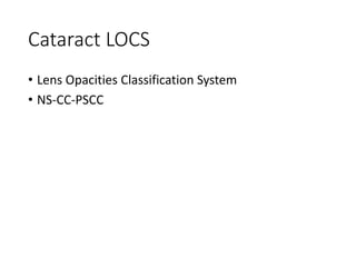 Cataract LOCS
• Lens Opacities Classification System
• NS-CC-PSCC
 