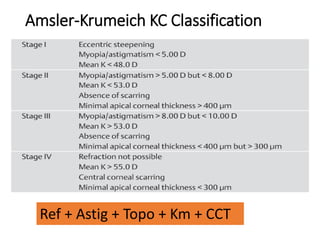 Ref + Astig + Topo + Km + CCT
Amsler-Krumeich KC Classification
 