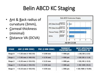 Belin ABCD KC Staging
• Ant & Back radius of
curvature (3mm),
• Corneal thickness
(minimal)
• Distance VA (DCVA)
 