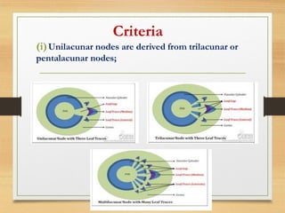 (i)Unilacunar nodes are derived from trilacunar or
pentalacunar nodes;
Criteria
 