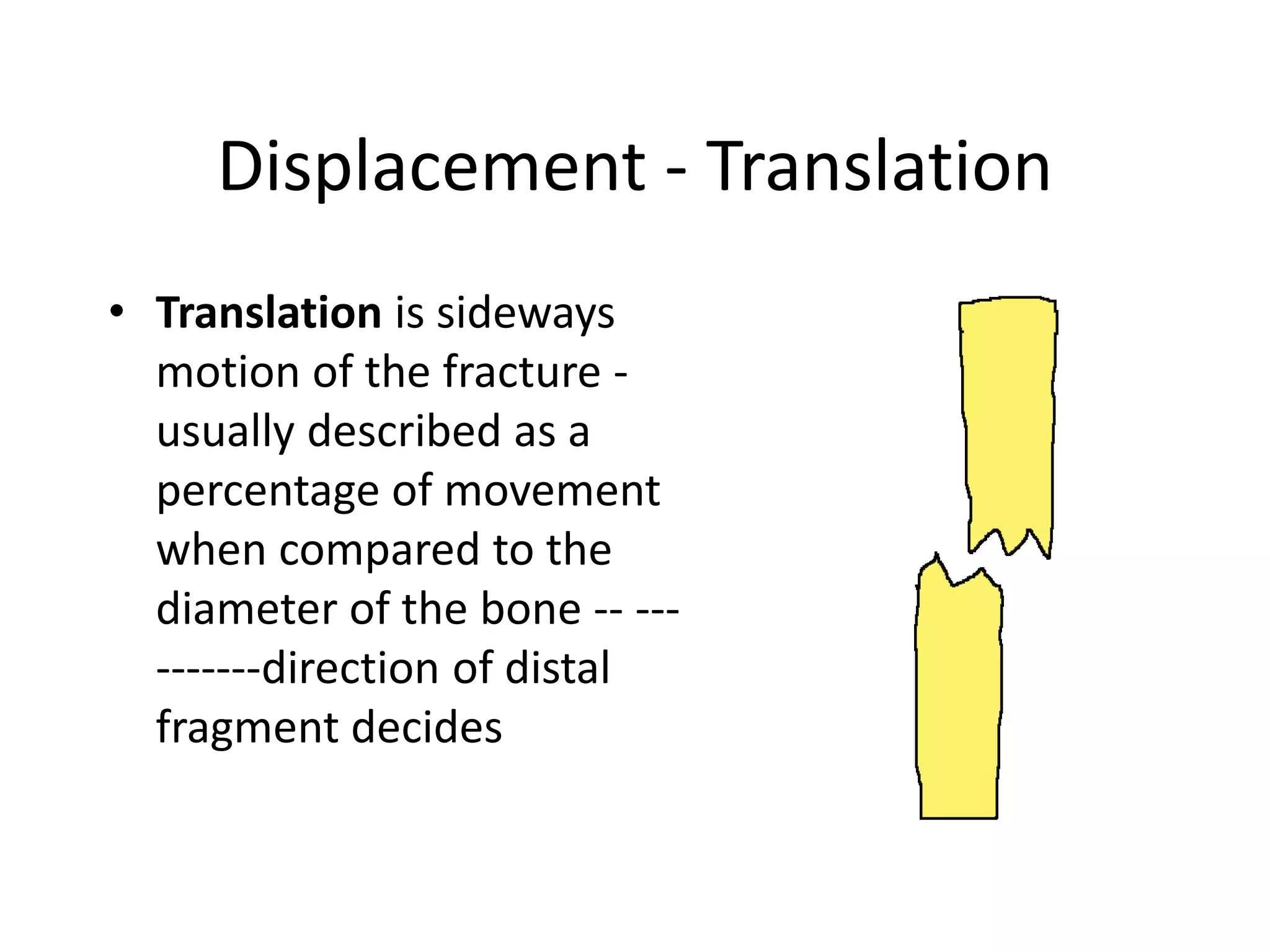 Displacement - Translation 
• Translation is sideways 
motion of the fracture - 
usually described as a 
percentage of movement 
when compared to the 
diameter of the bone -- --- 
-------direction of distal 
fragment decides 
 