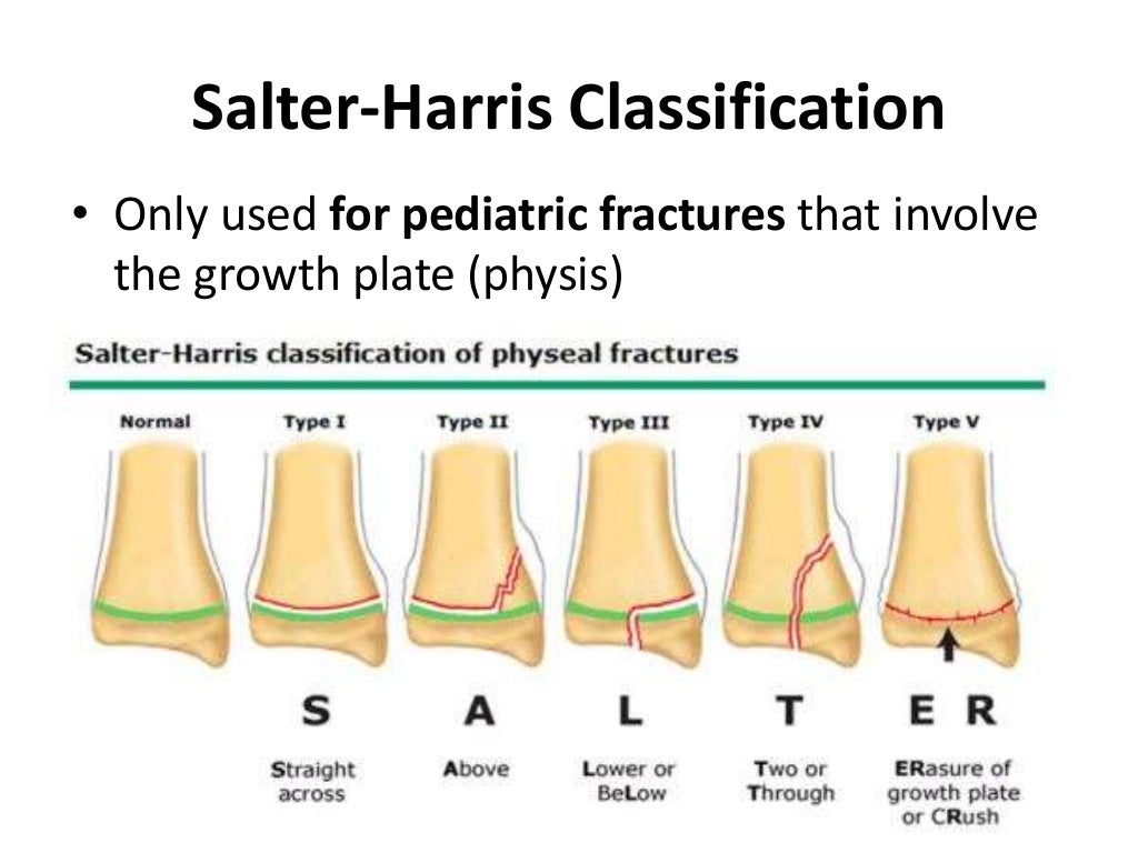 salter harris fracture classification