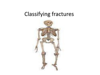 Classifying fractures
 