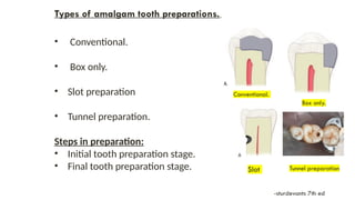 Class II Composite and Amalgam Preperation | PPTX