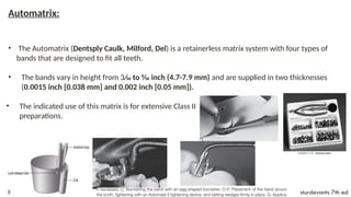 Class II Composite and Amalgam Preperation | PPTX