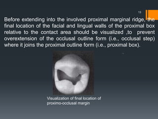 Before extending into the involved proximal marginal ridge, the
final location of the facial and lingual walls of the proximal box
relative to the contact area should be visualized ,to prevent
overextension of the occlusal outline form (i.e., occlusal step)
where it joins the proximal outline form (i.e., proximal box).
13
Visualization of final location of
proximo-occlusal margin
 