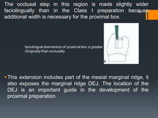 The occlusal step in this region is made slightly wider
faciolingually than in the Class I preparation because
additional width is necessary for the proximal box.
This extension includes part of the mesial marginal ridge, it
also exposes the marginal ridge DEJ. The location of the
DEJ is an important guide in the development of the
proximal preparation.
15
 