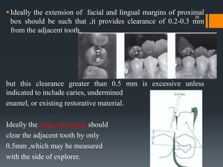 20
Ideally the extension of facial and lingual margins of proximal
box should be such that ,it provides clearance of 0.2-0.3 mm
from the adjacent tooth.
but this clearance greater than 0.5 mm is excessive unless
indicated to include caries, undermined
enamel, or existing restorative material.
Ideally the gingival margin should
clear the adjacent tooth by only
0.5mm ,which may be measured
with the side of explorer.
 