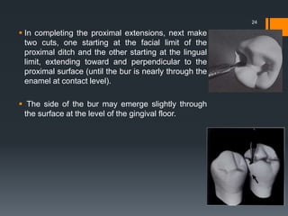  In completing the proximal extensions, next make
two cuts, one starting at the facial limit of the
proximal ditch and the other starting at the lingual
limit, extending toward and perpendicular to the
proximal surface (until the bur is nearly through the
enamel at contact level).
 The side of the bur may emerge slightly through
the surface at the level of the gingival floor.
24
 