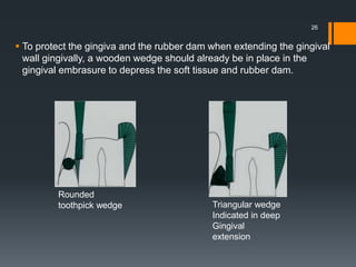  To protect the gingiva and the rubber dam when extending the gingival
wall gingivally, a wooden wedge should already be in place in the
gingival embrasure to depress the soft tissue and rubber dam.
26
Rounded
toothpick wedge Triangular wedge
Indicated in deep
Gingival
extension
 