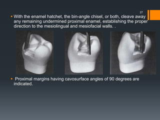  With the enamel hatchet, the bin-angle chisel, or both, cleave away
any remaining undermined proximal enamel, establishing the proper
direction to the mesiolingual and mesiofacial walls. .
 Proximal margins having cavosurface angles of 90 degrees are
indicated.
27
 