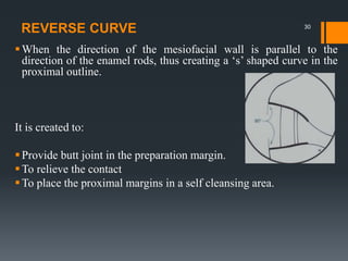 REVERSE CURVE
When the direction of the mesiofacial wall is parallel to the
direction of the enamel rods, thus creating a ‘s’ shaped curve in the
proximal outline.
It is created to:
Provide butt joint in the preparation margin.
To relieve the contact
To place the proximal margins in a self cleansing area.
30
 