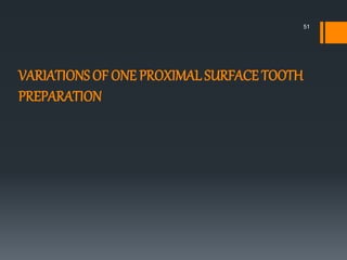 51
VARIATIONS OF ONE PROXIMAL SURFACE TOOTH
PREPARATION
 