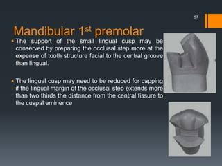 Mandibular 1st premolar
 The support of the small lingual cusp may be
conserved by preparing the occlusal step more at the
expense of tooth structure facial to the central groove
than lingual.
 The lingual cusp may need to be reduced for capping
if the lingual margin of the occlusal step extends more
than two thirds the distance from the central fissure to
the cuspal eminence
57
 