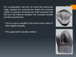 For a preparation that will not cross the transverse
ridge, prepare the proximal box before the occlusal
portion to prevent removing the tooth structure that
will form the isthmus between the occlusal dovetail
and the proximal box.
 The bur axis is parallel to the tooth crown which is
tilted slightly lingually
 The pulpal wall is facially inclined
59
 