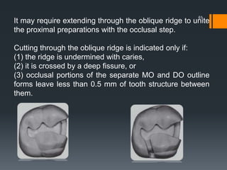 61
It may require extending through the oblique ridge to unite
the proximal preparations with the occlusal step.
Cutting through the oblique ridge is indicated only if:
(1) the ridge is undermined with caries,
(2) it is crossed by a deep fissure, or
(3) occlusal portions of the separate MO and DO outline
forms leave less than 0.5 mm of tooth structure between
them.
 