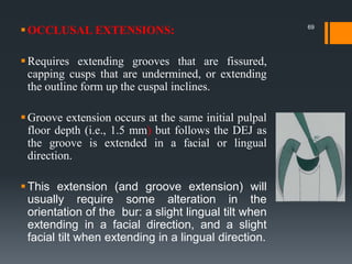 OCCLUSAL EXTENSIONS:
Requires extending grooves that are fissured,
capping cusps that are undermined, or extending
the outline form up the cuspal inclines.
Groove extension occurs at the same initial pulpal
floor depth (i.e., 1.5 mm) but follows the DEJ as
the groove is extended in a facial or lingual
direction.
This extension (and groove extension) will
usually require some alteration in the
orientation of the bur: a slight lingual tilt when
extending in a facial direction, and a slight
facial tilt when extending in a lingual direction.
69
 
