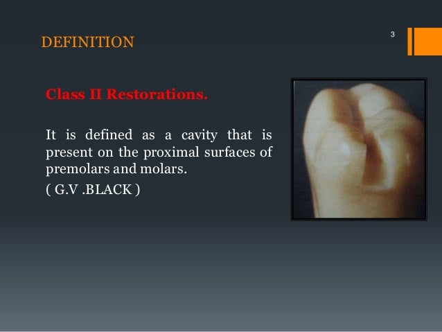 Class Ii Amalgam