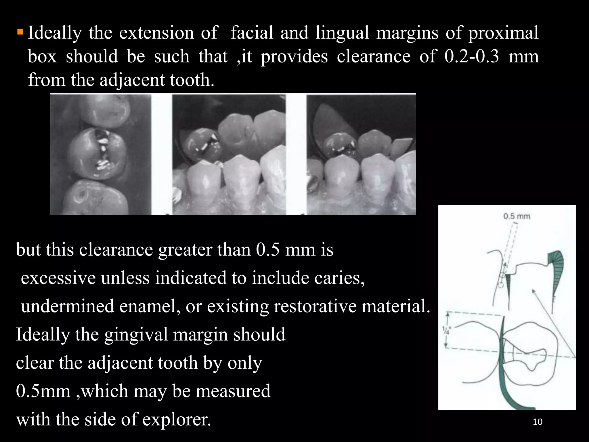 10
Ideally the extension of facial and lingual margins of proximal
box should be such that ,it provides clearance of 0.2-0.3 mm
from the adjacent tooth.
but this clearance greater than 0.5 mm is
excessive unless indicated to include caries,
undermined enamel, or existing restorative material.
Ideally the gingival margin should
clear the adjacent tooth by only
0.5mm ,which may be measured
with the side of explorer.
 