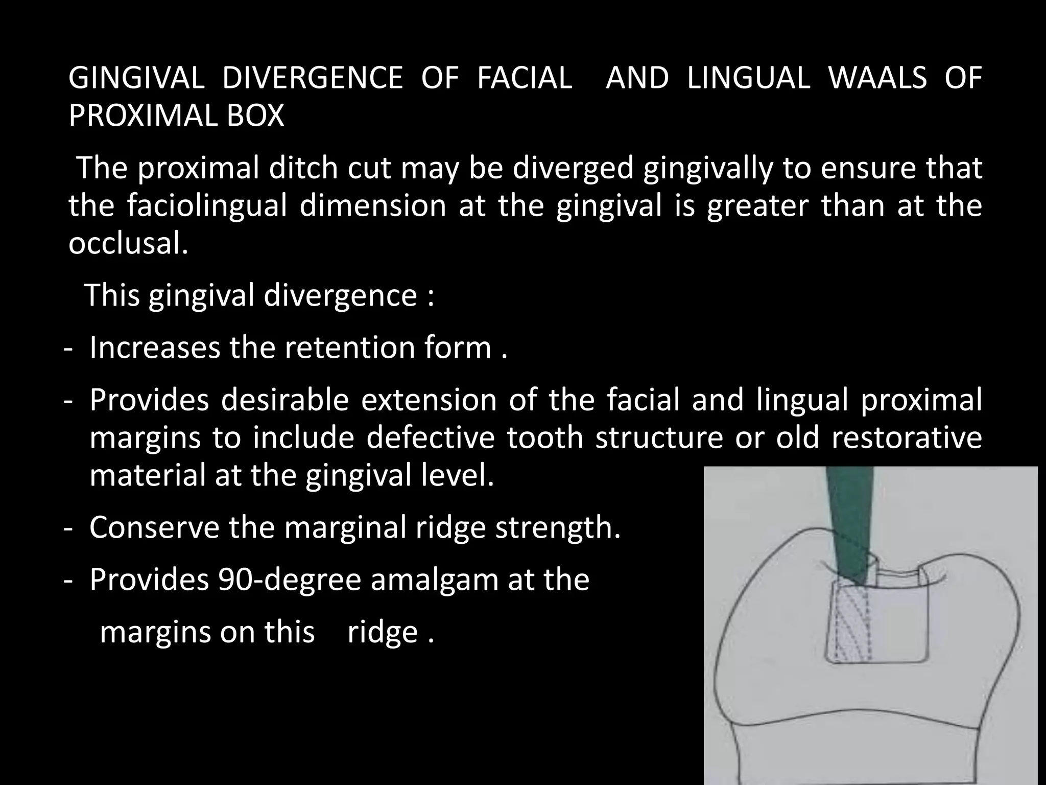 GINGIVAL DIVERGENCE OF FACIAL AND LINGUAL WAALS OF
PROXIMAL BOX
The proximal ditch cut may be diverged gingivally to ensure that
the faciolingual dimension at the gingival is greater than at the
occlusal.
This gingival divergence :
- Increases the retention form .
- Provides desirable extension of the facial and lingual proximal
margins to include defective tooth structure or old restorative
material at the gingival level.
- Conserve the marginal ridge strength.
- Provides 90-degree amalgam at the
margins on this ridge .
13
 