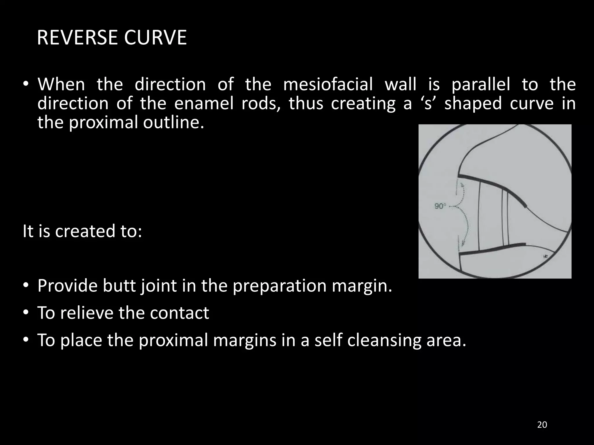REVERSE CURVE
• When the direction of the mesiofacial wall is parallel to the
direction of the enamel rods, thus creating a ‘s’ shaped curve in
the proximal outline.
It is created to:
• Provide butt joint in the preparation margin.
• To relieve the contact
• To place the proximal margins in a self cleansing area.
20
 