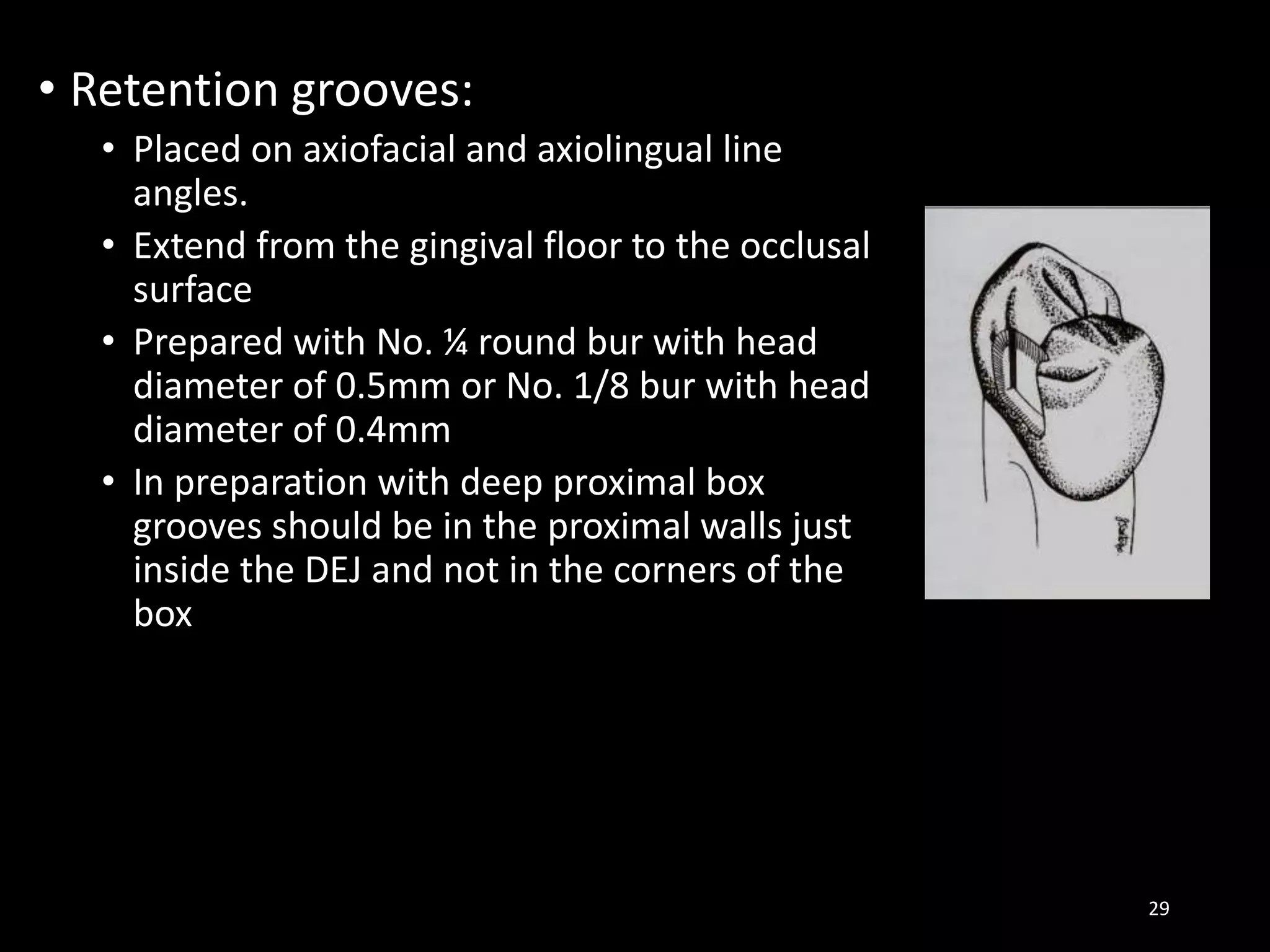 • Retention grooves:
• Placed on axiofacial and axiolingual line
angles.
• Extend from the gingival floor to the occlusal
surface
• Prepared with No. ¼ round bur with head
diameter of 0.5mm or No. 1/8 bur with head
diameter of 0.4mm
• In preparation with deep proximal box
grooves should be in the proximal walls just
inside the DEJ and not in the corners of the
box
29
 