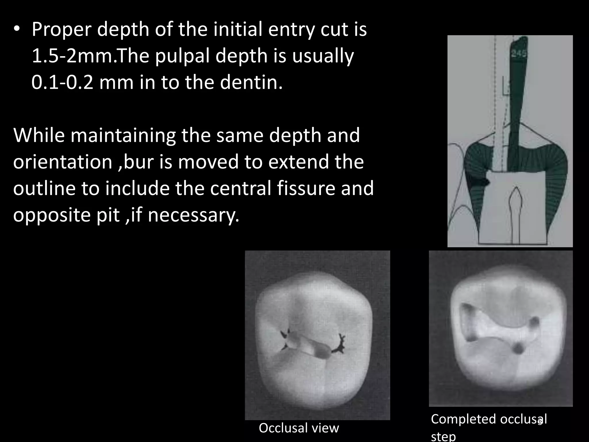 3
• Proper depth of the initial entry cut is
1.5-2mm.The pulpal depth is usually
0.1-0.2 mm in to the dentin.
While maintaining the same depth and
orientation ,bur is moved to extend the
outline to include the central fissure and
opposite pit ,if necessary.
Completed occlusal
step
Occlusal view
 