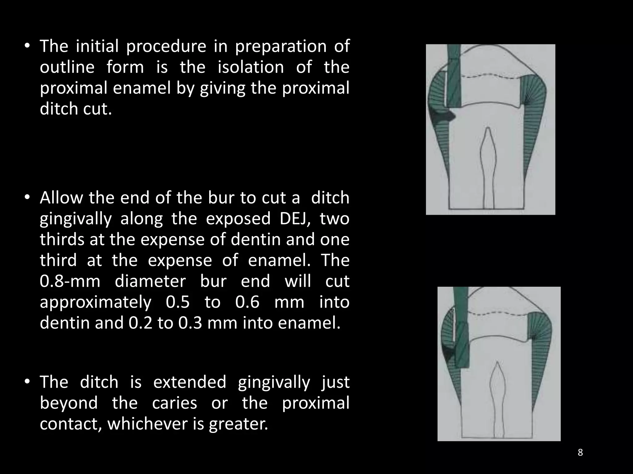 • The initial procedure in preparation of
outline form is the isolation of the
proximal enamel by giving the proximal
ditch cut.
• Allow the end of the bur to cut a ditch
gingivally along the exposed DEJ, two
thirds at the expense of dentin and one
third at the expense of enamel. The
0.8-mm diameter bur end will cut
approximately 0.5 to 0.6 mm into
dentin and 0.2 to 0.3 mm into enamel.
• The ditch is extended gingivally just
beyond the caries or the proximal
contact, whichever is greater.
8
 