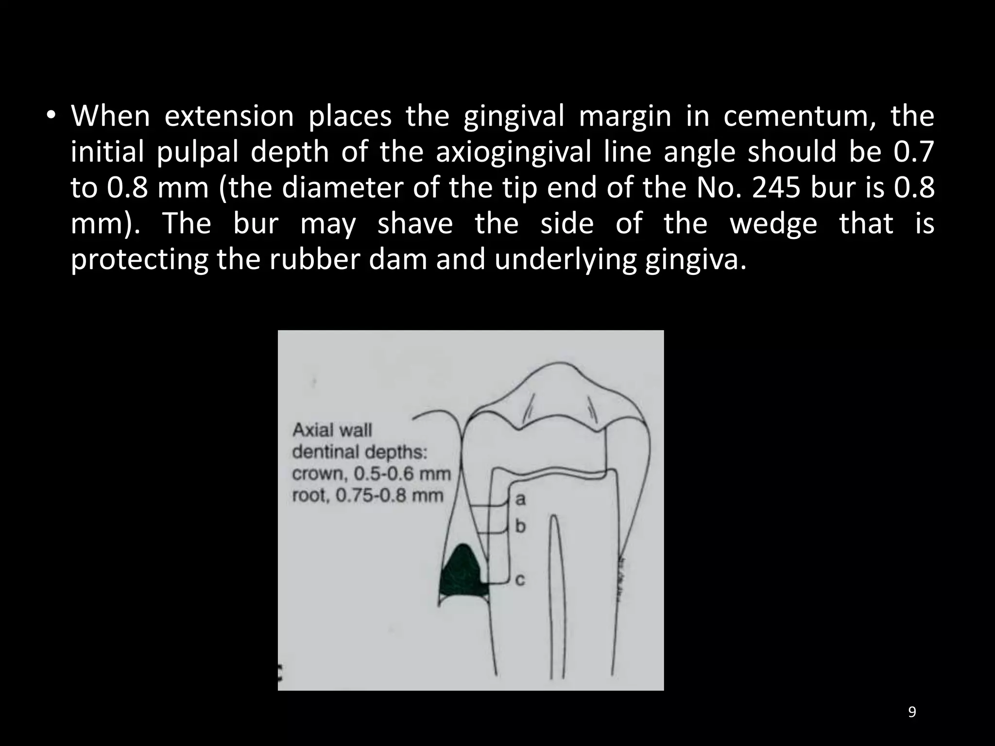 • When extension places the gingival margin in cementum, the
initial pulpal depth of the axiogingival line angle should be 0.7
to 0.8 mm (the diameter of the tip end of the No. 245 bur is 0.8
mm). The bur may shave the side of the wedge that is
protecting the rubber dam and underlying gingiva.
9
 