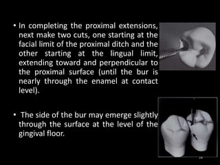 • In completing the proximal extensions,
next make two cuts, one starting at the
facial limit of the proximal ditch and the
other starting at the lingual limit,
extending toward and perpendicular to
the proximal surface (until the bur is
nearly through the enamel at contact
level).
• The side of the bur may emerge slightly
through the surface at the level of the
gingival floor.
14
 