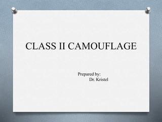 CLASS II CAMOUFLAGE 
Prepared by: 
Dr. Kristel 
 