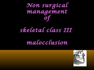 Non surgicalNon surgical
managementmanagement
ofof
skeletal class IIIskeletal class III
malocclusionmalocclusion
 