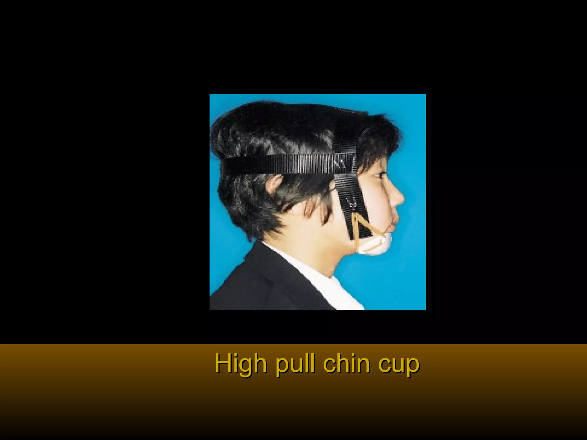 High pull chin cupHigh pull chin cup
 